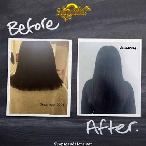 Anti-Itch & Hair Growth Oil