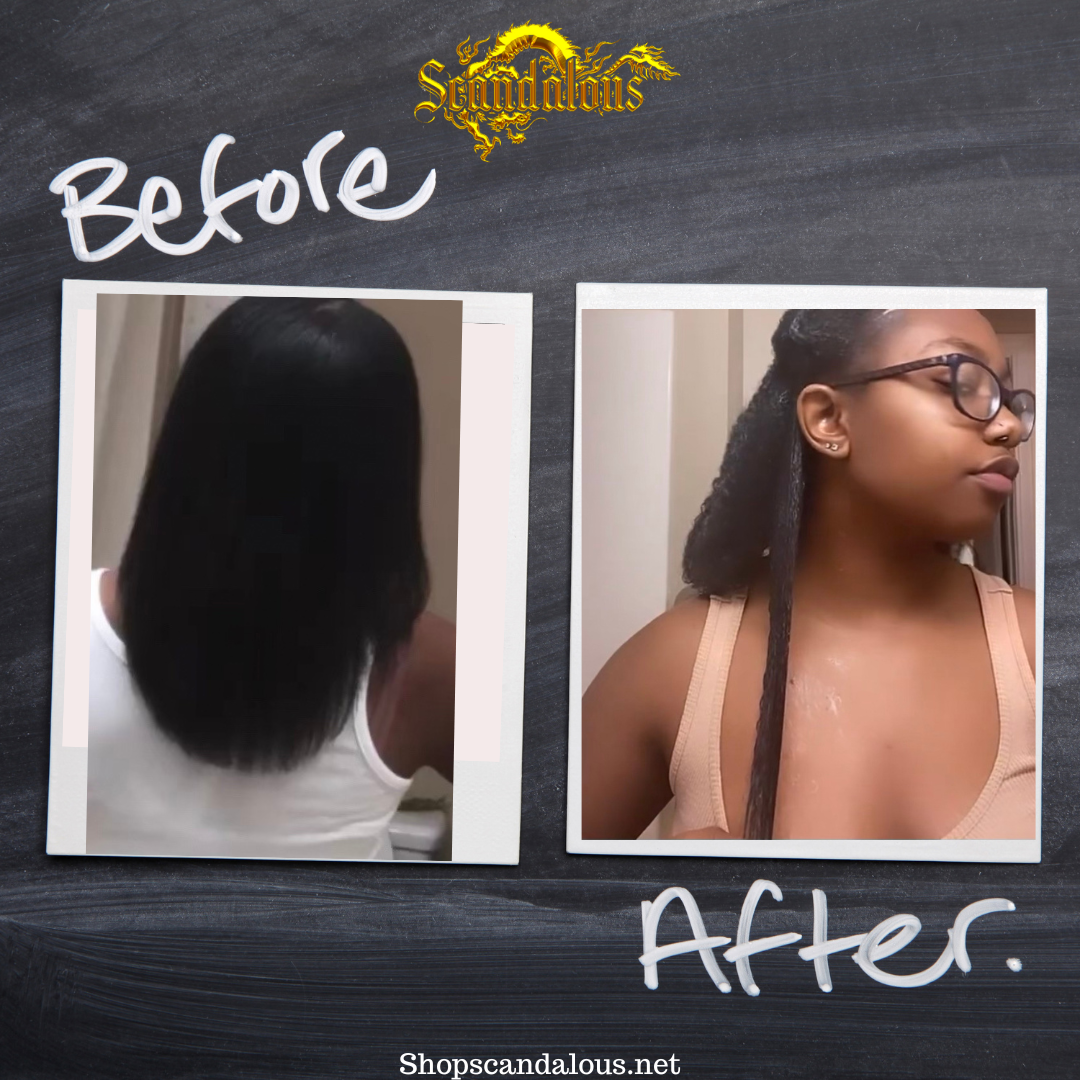 Anti-Itch & Hair Growth Oil