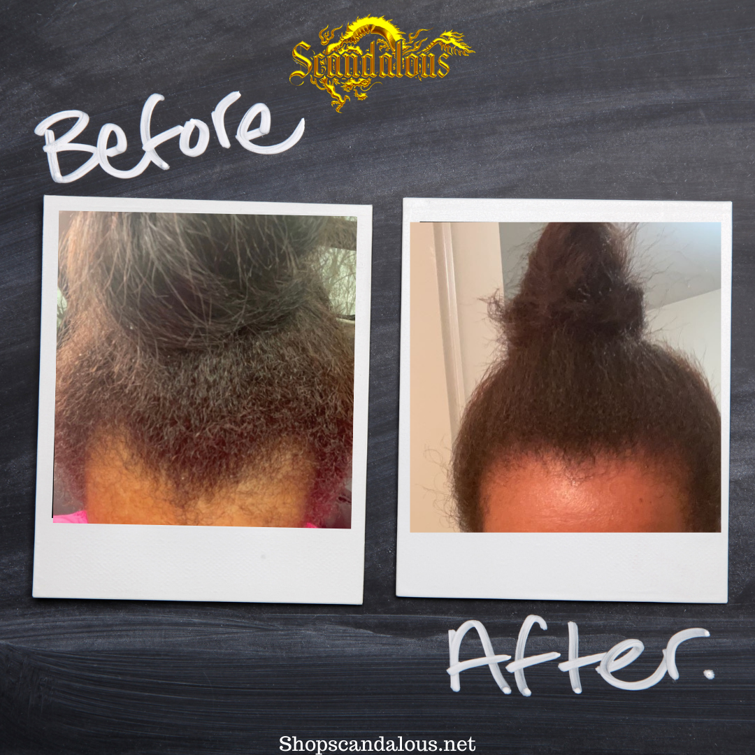 Anti-Itch & Hair Growth Oil